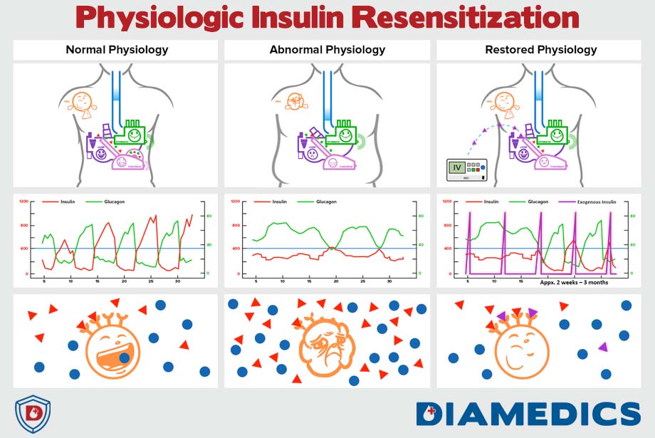 https://diamedics.com/wp-content/uploads/2024/09/PIR-Treatment-Diamedics.jpg