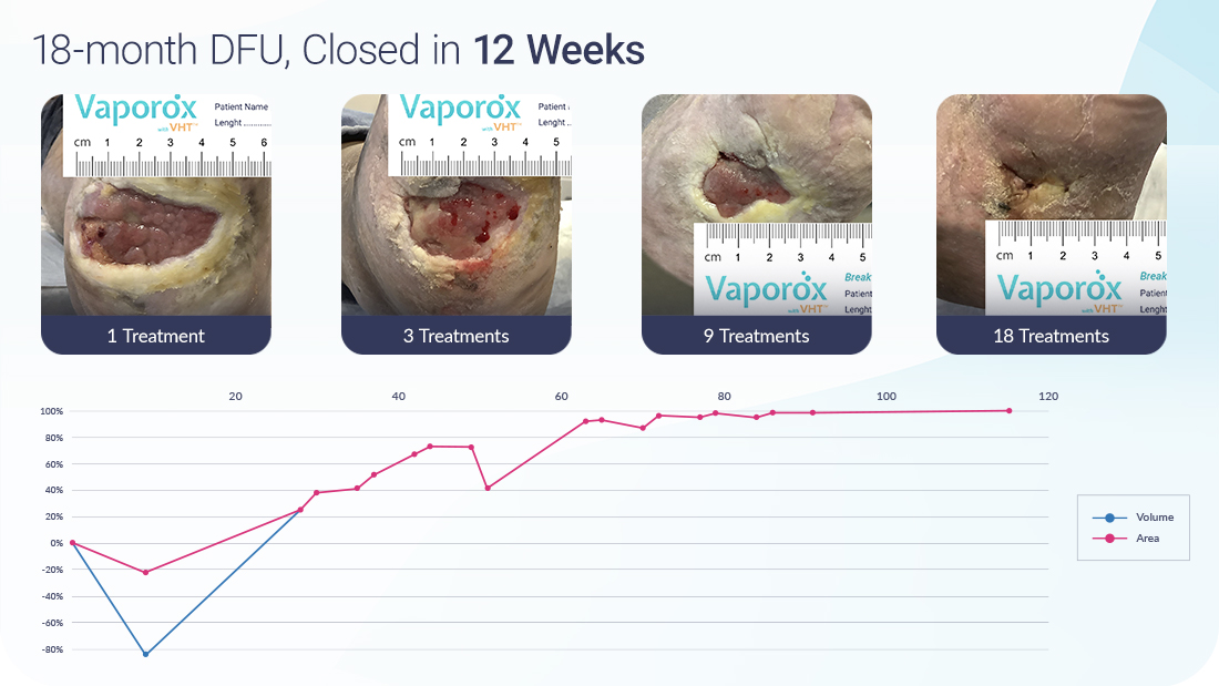 Vaporox-Case-Study-DFU-18-months-12-weeks