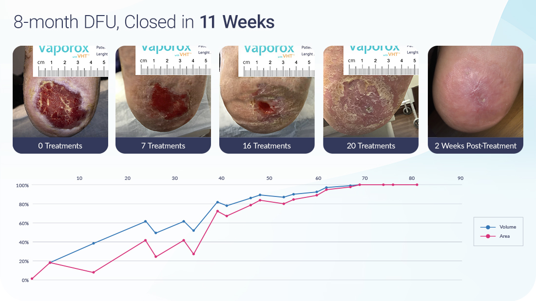 Vaporox-Case-Study-DFU-8-months-11-weeks